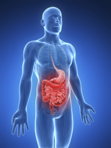 3D image showing affects of colon cancer