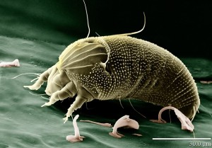 This dust mite makes many people allergic