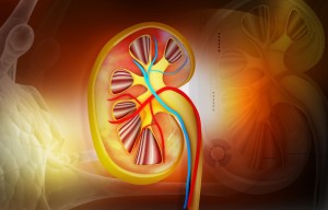 Clinical trial participant's cancerous kidney