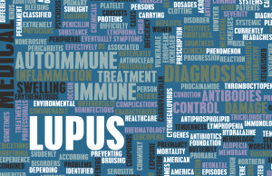 Information about lupus clinical trials