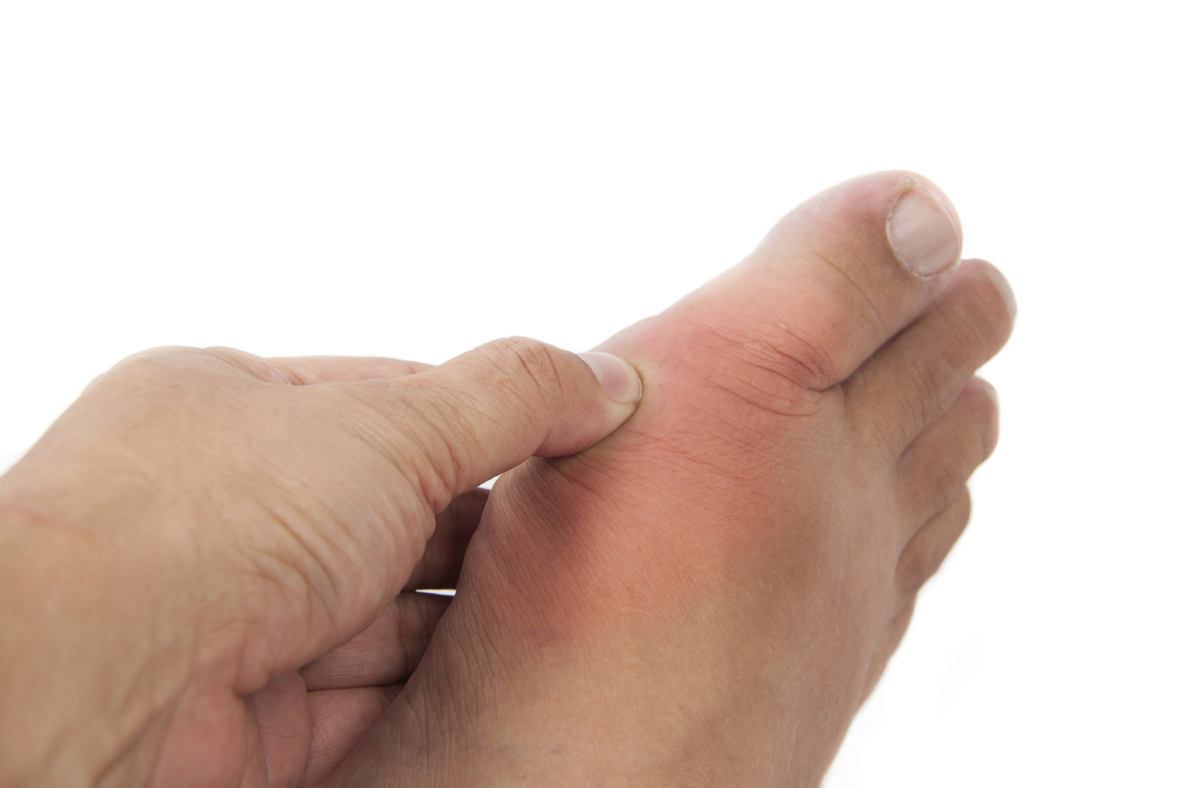 Inspecting symptoms of gout in the big toe