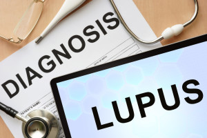 Doctor's notes from lupus lab tests