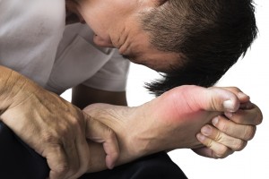 Man suffering from gouty arthritis attacks in toe